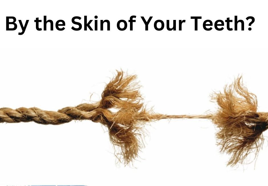 By the Skin of My Teeth?
